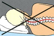 Tempur Kissen falsche Kopfstellung Illustration Tempur Kissen falsche Kopfstellung Illustration